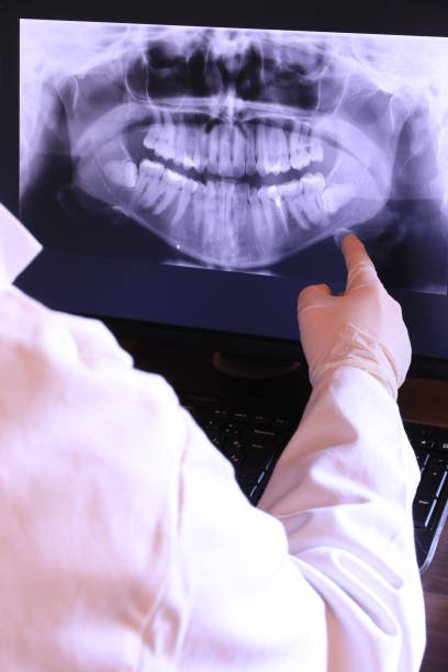 Best Emergency Wisdom Teeth Removal in Florence, TX